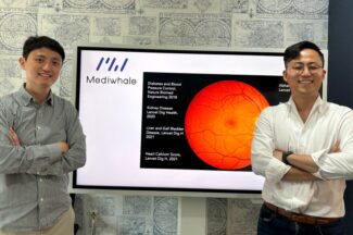 [바스리] 망막사진으로 심혈관 질환을 예측할 수 있다